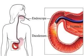 endoscope gland